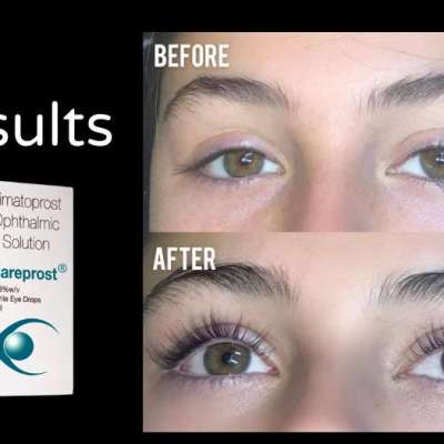 Careprost Eyelash Growth Serum Profile Picture