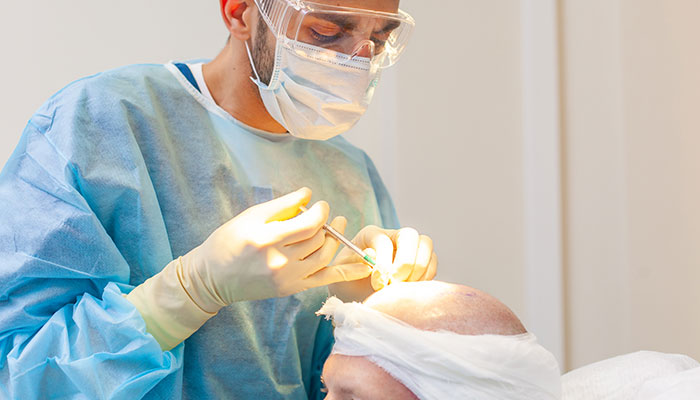 Get The Best Hair Transplant In Chennai