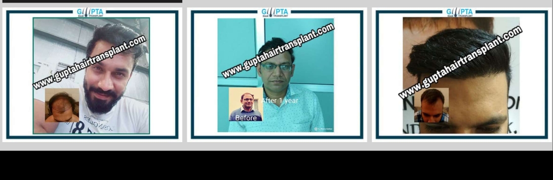 Gupta Hair Transplant