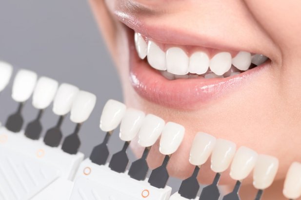 How to Get the Best Results from the Latest Teeth Whitening Technology Article - ArticleTed -  News and Articles