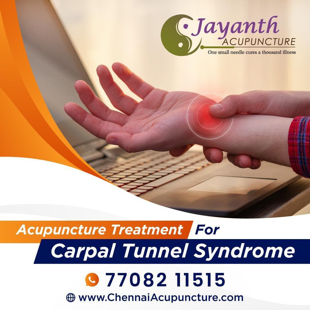 Acupuncture Treatment For Carpal Tunnel Syndrome in ChennaiBest Acupuncture Treatment by Well Experienced Acupuncture Doctor in Chennai