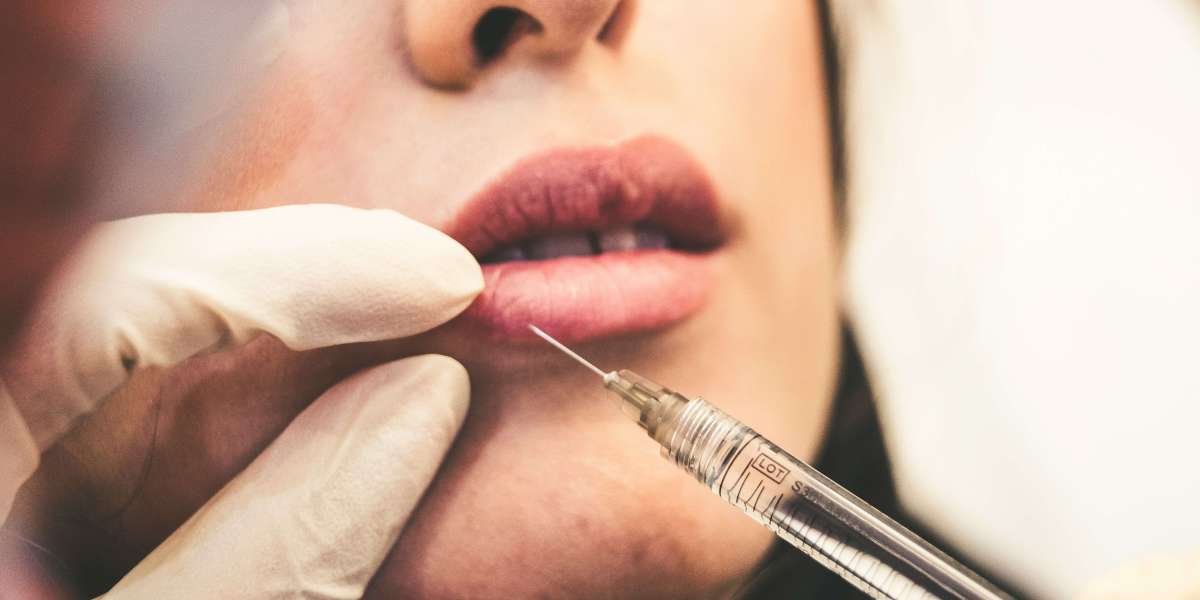 Wie lange hält ein Lip Flip und wann sollte es wiederholt werden
