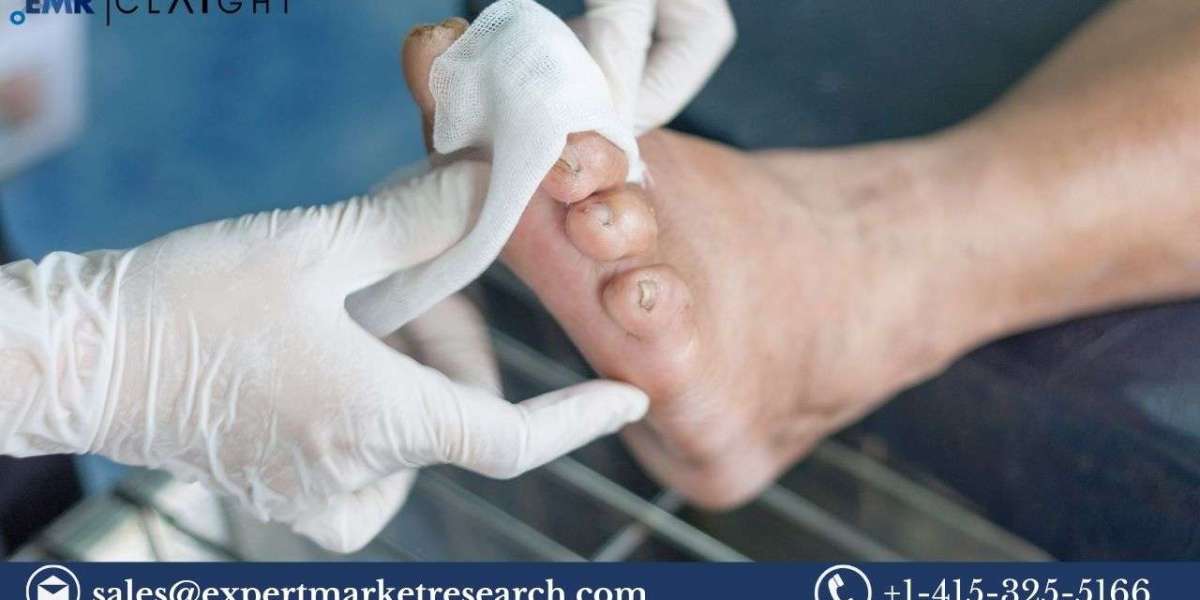 Diabetic Ulcer Treatment Market: Size, Trend Growth (2025-2034)