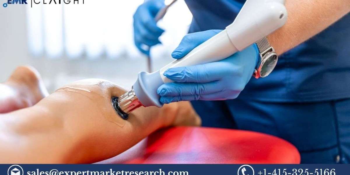 Shock wave therapy device market: Trend, Size and Growth (2025-2034)