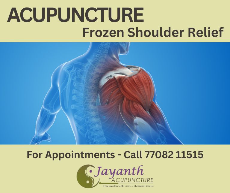 Acupuncture for Frozen Shoulder: 7 Ways It Improves MobilityBest Acupuncture Treatment by Well Experienced Acupuncture Doctor in Chennai