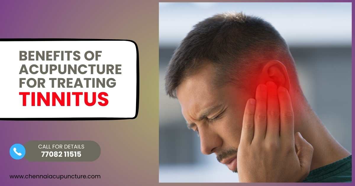 5 Super Benefits Of Acupuncture For Tinnitus Treatment