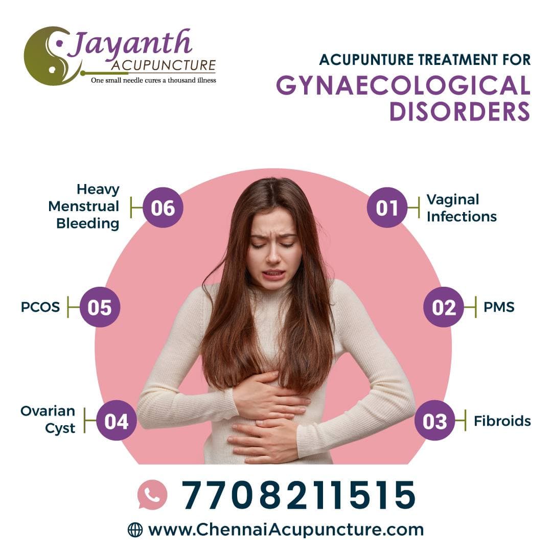 The Best Acupuncture Treatment For Gynaecological Disorders in ChennaiBest Acupuncture Treatment by Well Experienced Acupuncture Doctor in Chennai