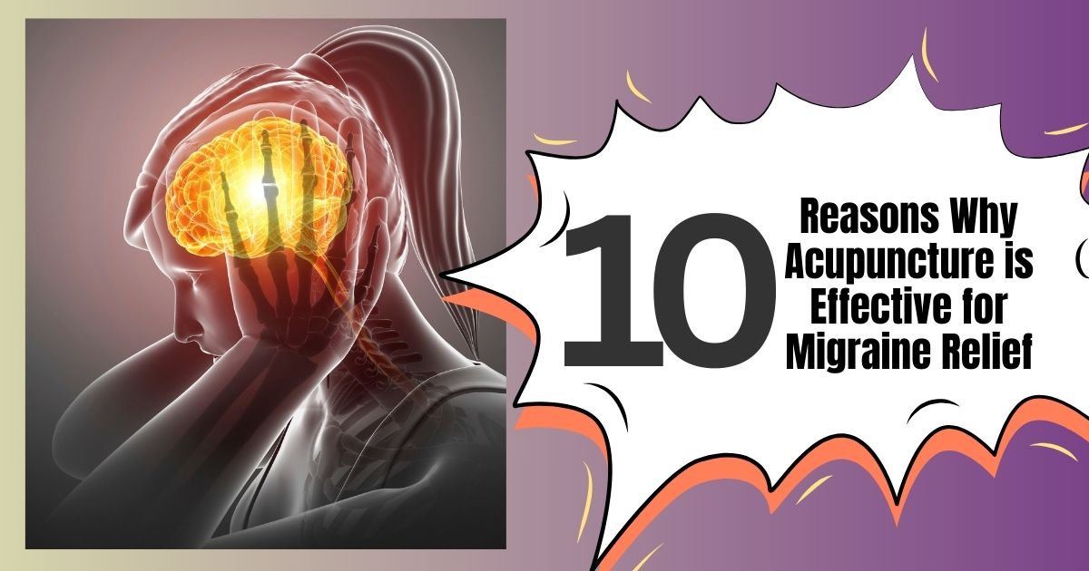 Acupuncture For Migraine Relief: 10 Proven Benefits