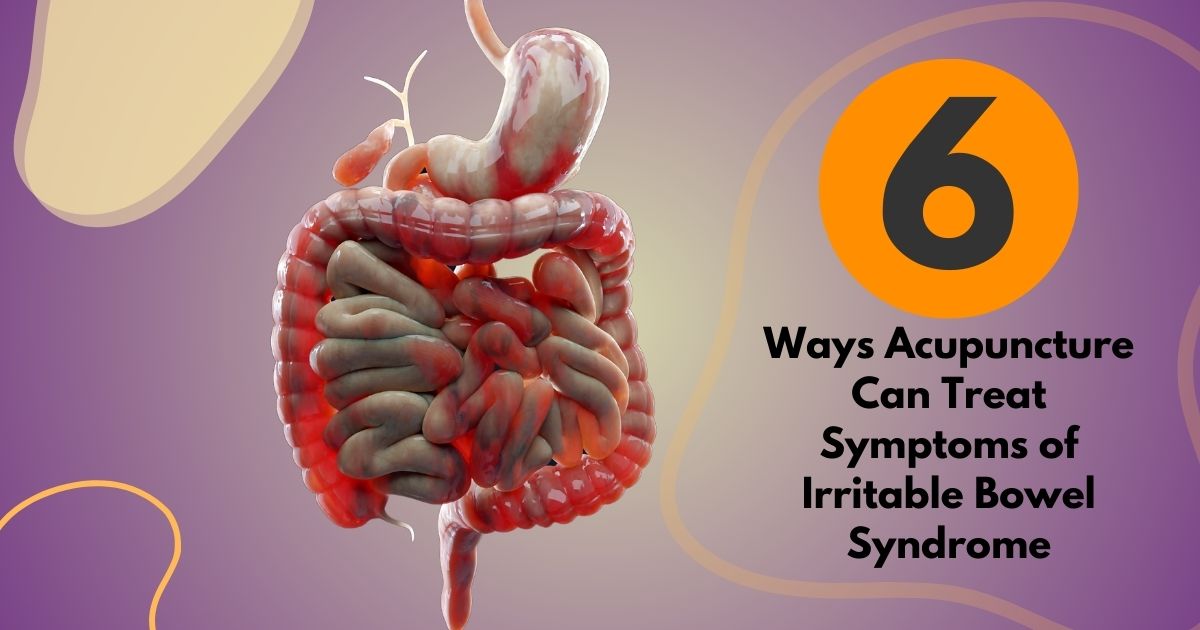 6 Best Ways Acupuncture For Irritable Bowel Syndrome Helps