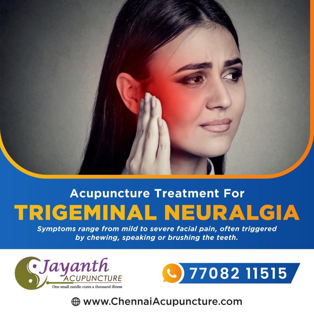 Acupuncture Treatment for Trigeminal Neuralgia Near Me in Chennai | AcupuncturistBest Acupuncture Treatment by Well Experienced Acupuncture Doctor in Chennai