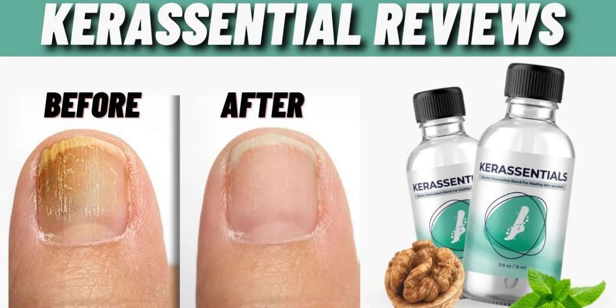 Kerassentials {SHOCKING PRICE} Is It Worth The Money?