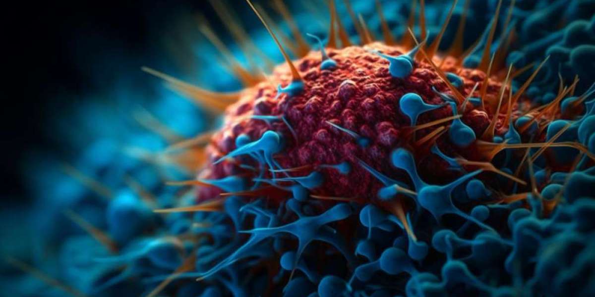 Huntington’s Disease Market Insights: Exploring the Emerging Treatment Landscape