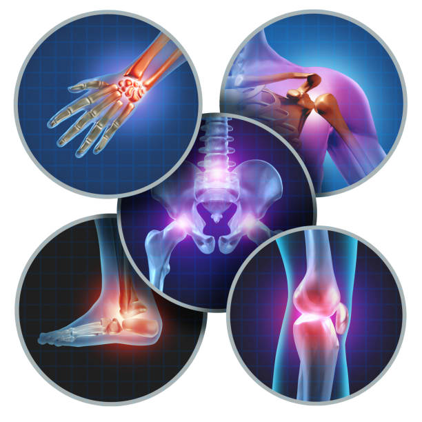Acupuncture Treatment For Arthritis In Chennai | Kneepain
