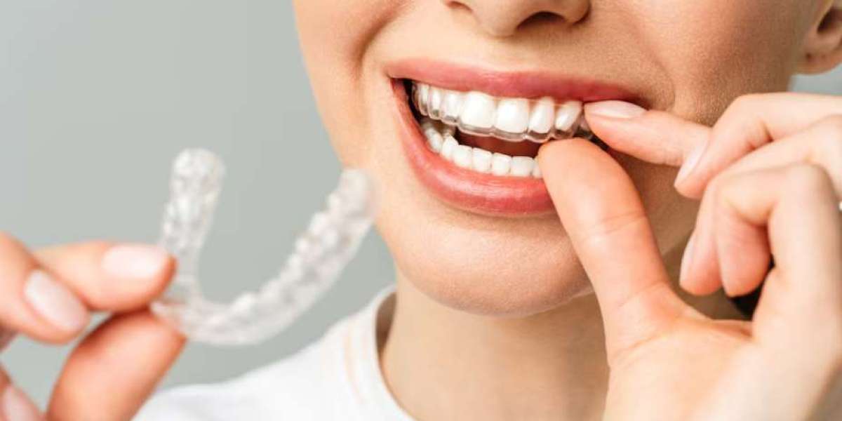 What are clear aligners, and how do they work to straighten teeth?