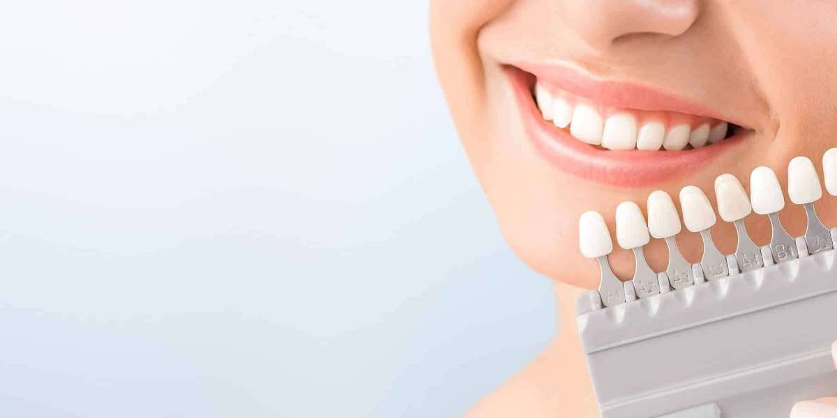 The Benefits of Adding Clear Braces to Your Dental Practice