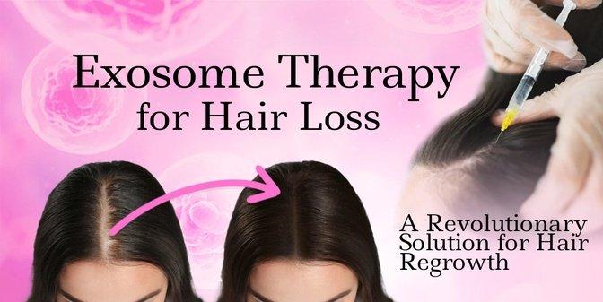 Exosomes for Hair Regeneration: How Hyderabad’s Clinics Are Changing the Game | Articles | dranirudhhairtransplant | Gan Jing World - Technology for Humanity | Video & Movie Streaming