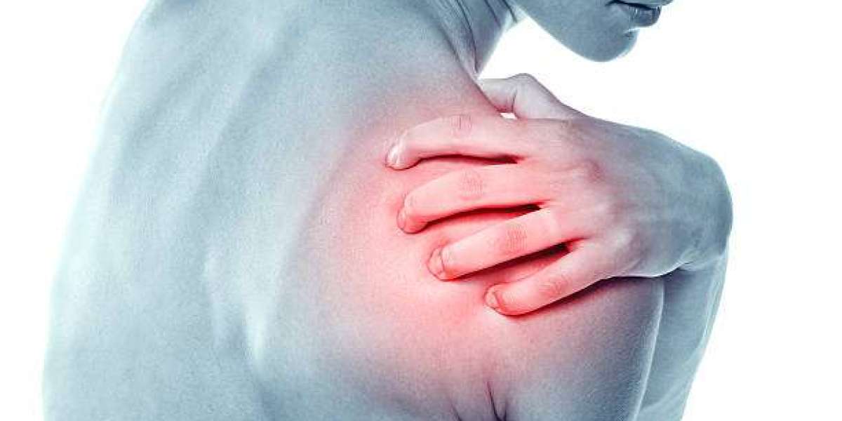 How Legend Physiotherapy Surrey Treats Frozen Shoulder Pain