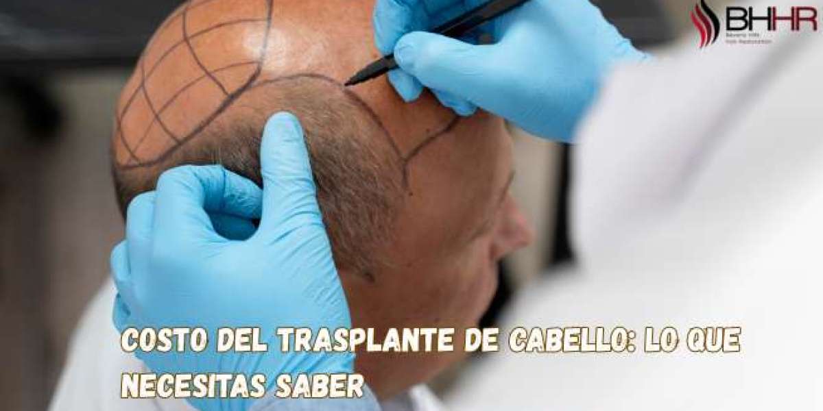 Costo del Trasplante de Cabello: Lo Que Necesitas Saber