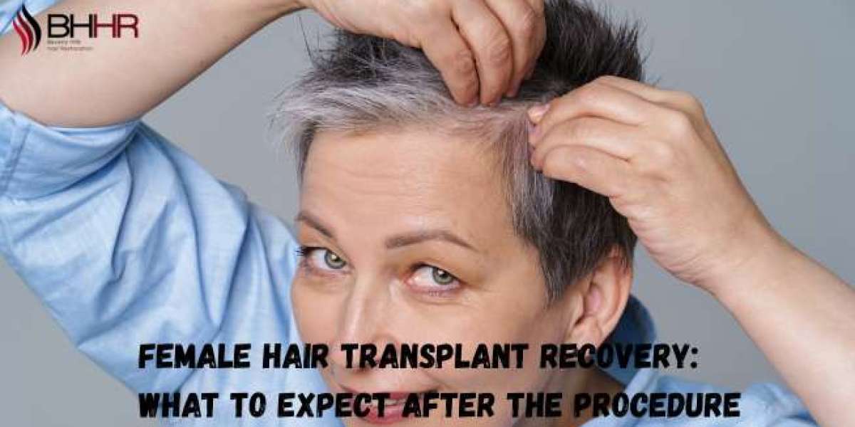Female Hair Transplant Recovery: What to Expect After the Procedure