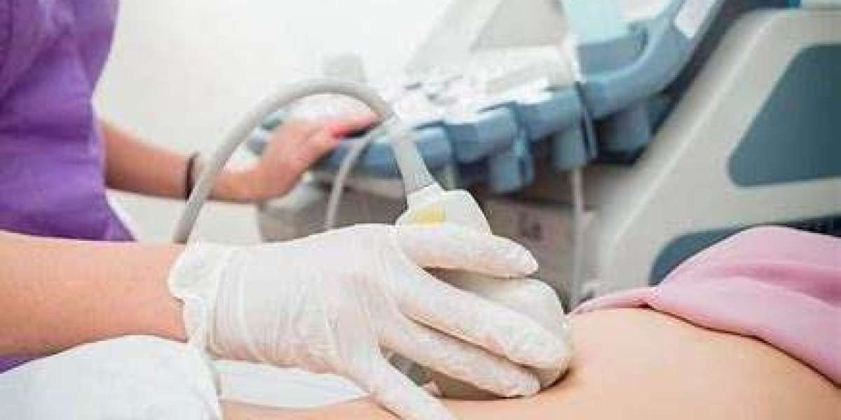 Ultrasound Scan Price – Factors, Types, and Affordable Options in 2024