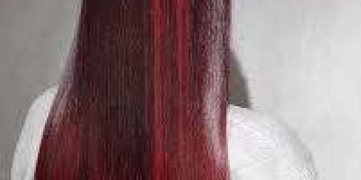 Hair Transplant in Turkey – Cost, Clinics, and What You Need to Know