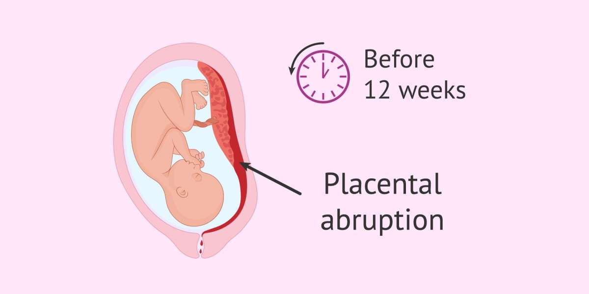 How Delayed Diagnosis During Pregnancy Can Cause Harm