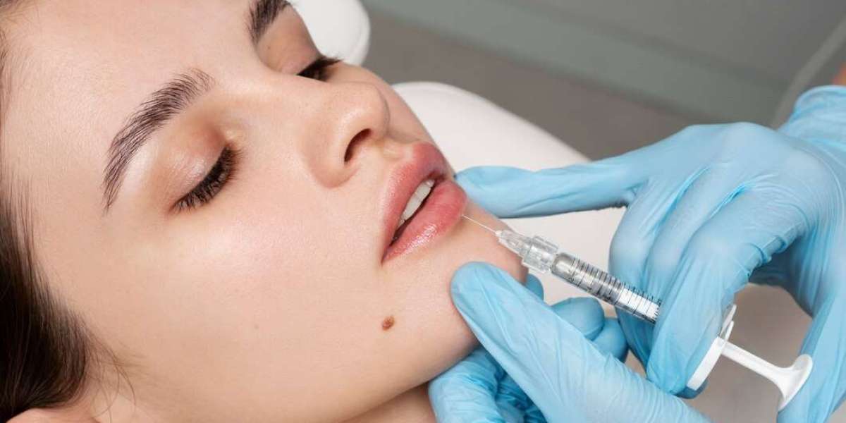 Top Botox Treatment in Reno Rejuvenate Your Look Today