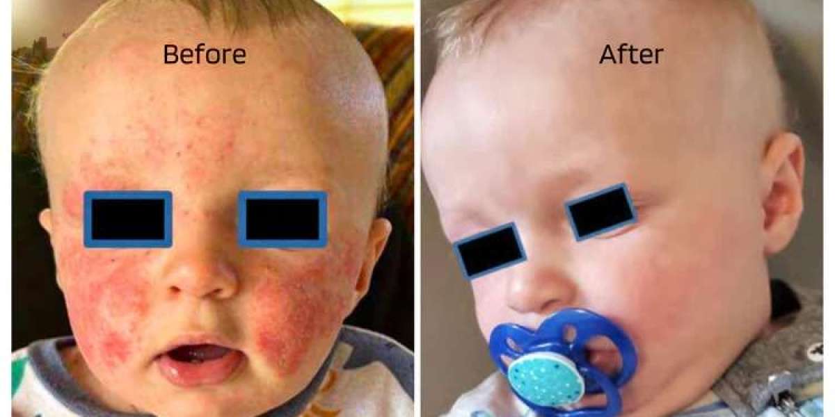Safe, Soothing Creams for Sensitive Skin Needs