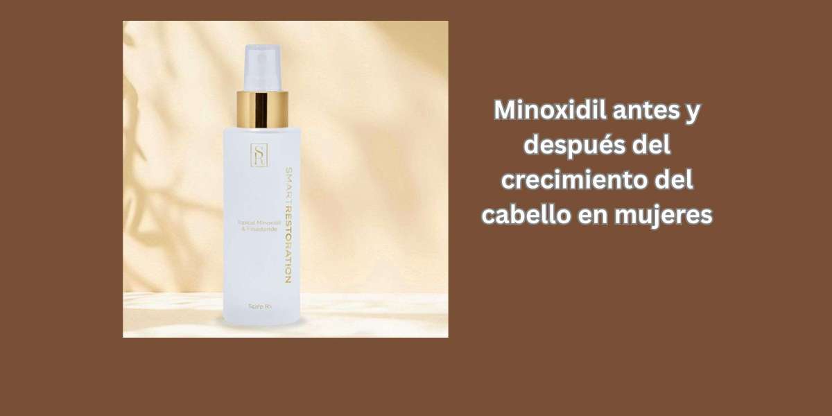 Minoxidil antes y después del crecimiento del cabello en mujeres