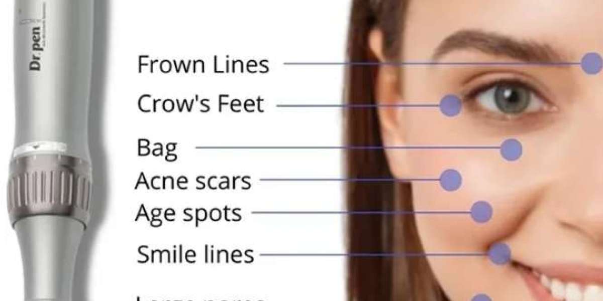 Wie sinnvoll ist Microneedling?