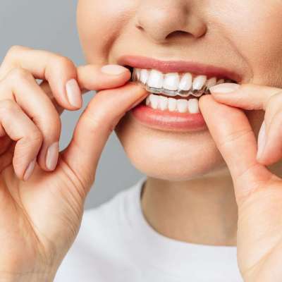 Crest White Strips – Achieve a Radiant Smile with The White Smiles Profile Picture
