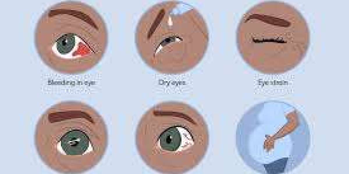 Top 10 Causes of Blurred Vision and How to Treat Them