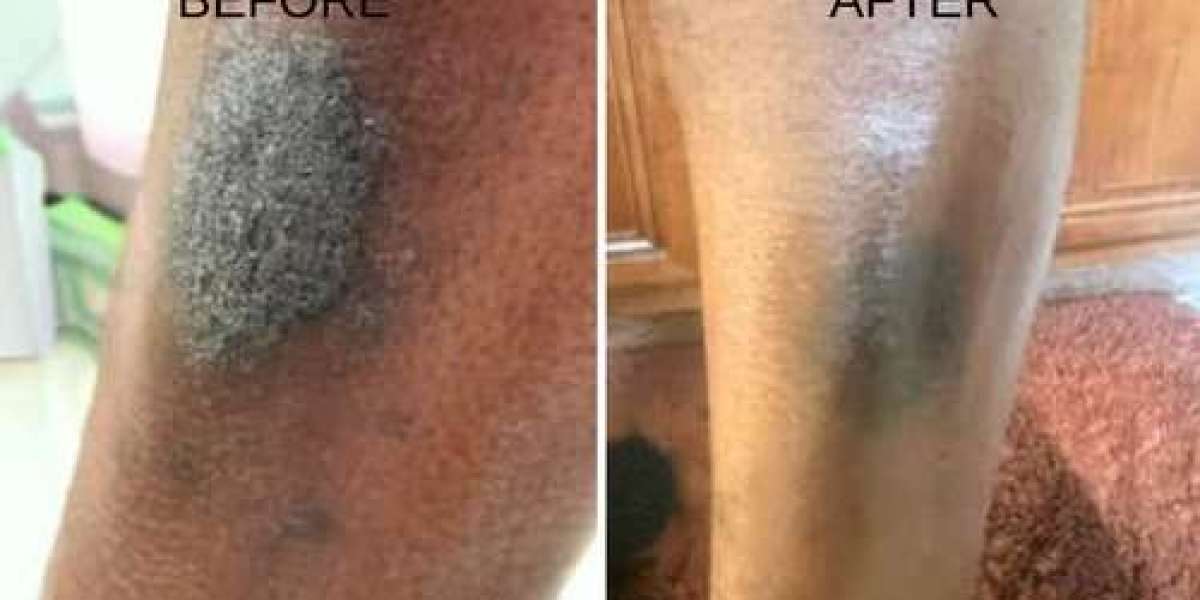 Discover the Power of Natural Body Creams Today