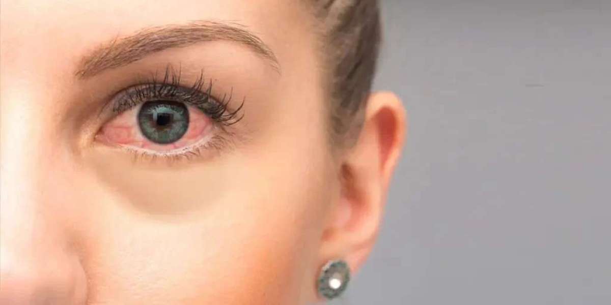 Protecting Vision from Behcet’s Disease: Role of Eye Centers