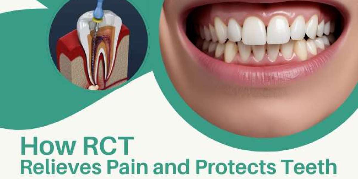 How RCT Relieves Pain and Protects Teeth