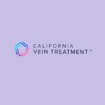 Vein Treatment California