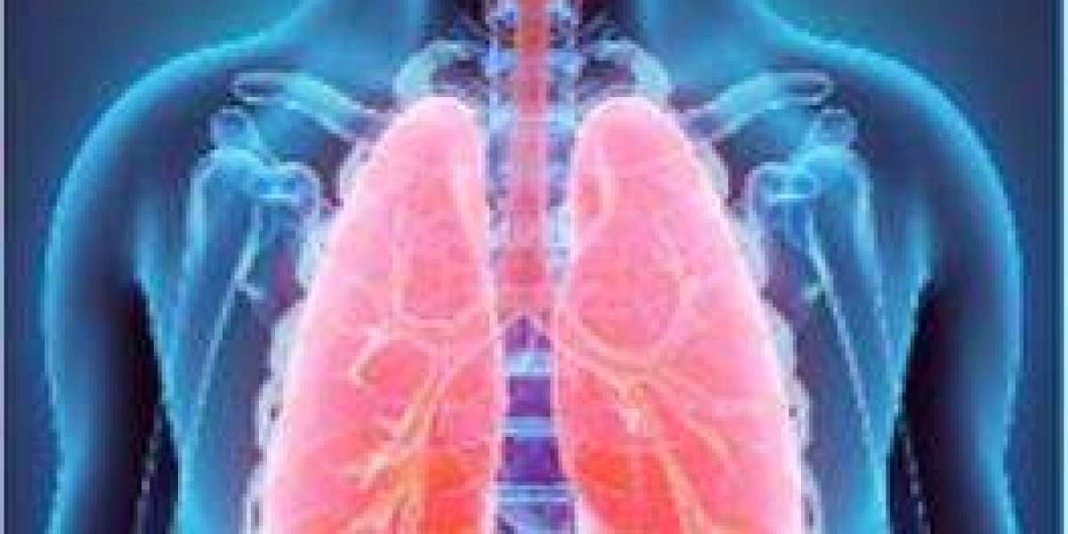 The Science of ADCC: Enhancing the Body’s Natural Cancer Defenses
