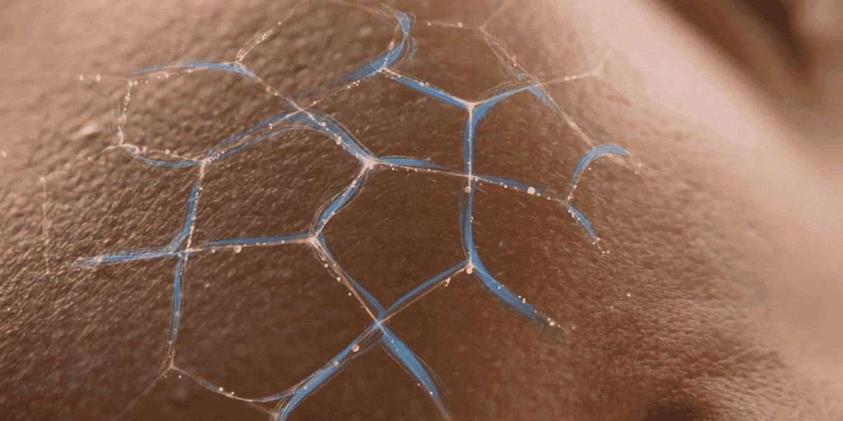 How Lipid Metabolism Fuels Steroid Hormones and Why Their Analysis Matters