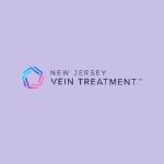 Vein Treatment New Jersey