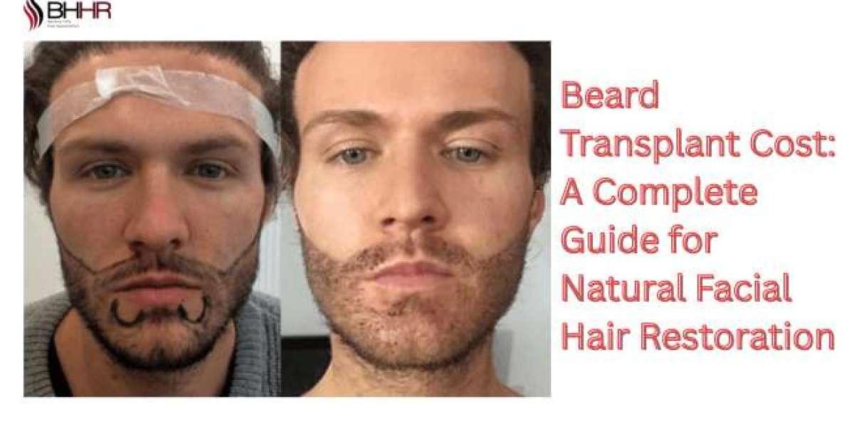 Beard Transplant Cost: A Complete Guide for Natural Facial Hair Restoration