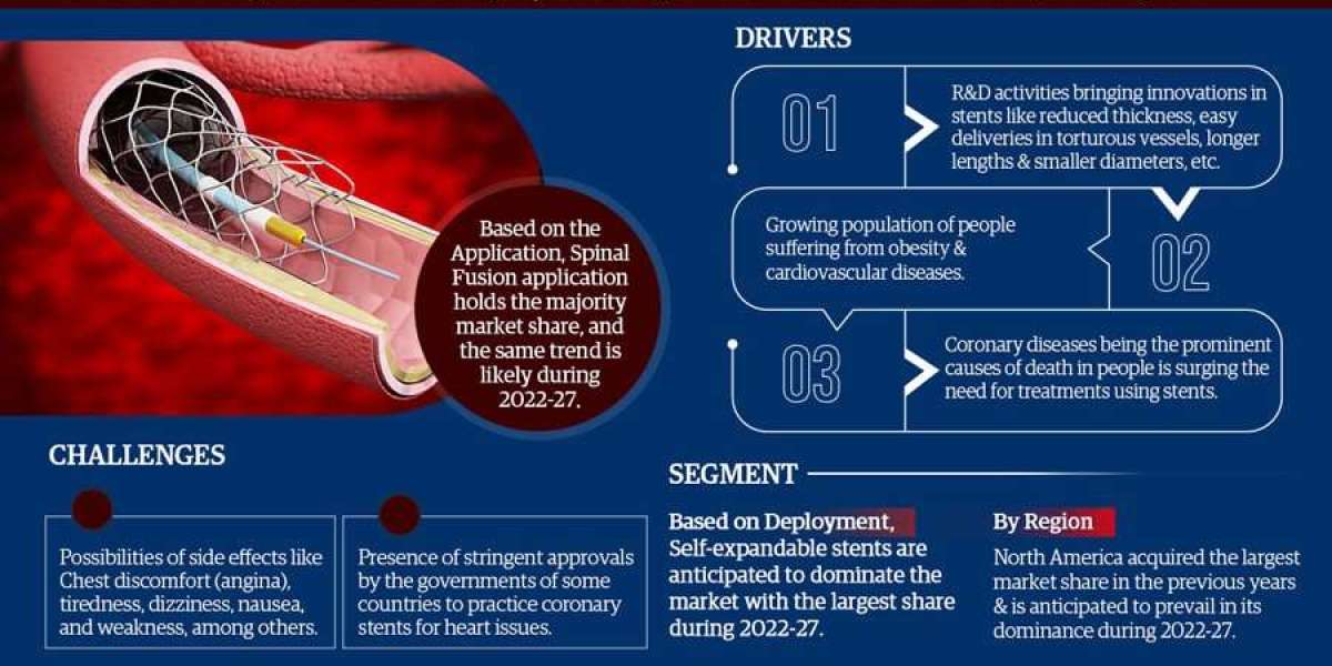 Coronary Stents Industry Analysis: Companies, Competitors & Outlook 2027