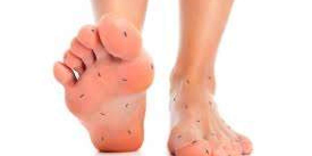 The Truth About Using Tapentadol for Diabetic Neuropathy Pain