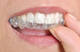 Is Invisalign More Painful Than Braces?