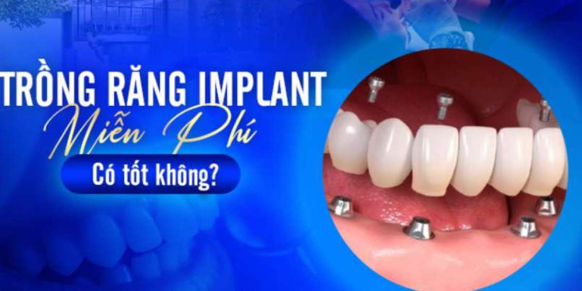 Trồng răng implant miễn phí có an toàn không?