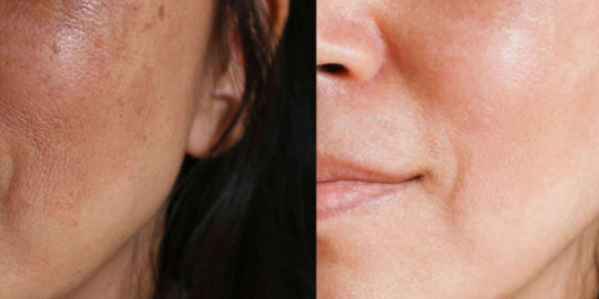 Best Skin Lightening Products from OKDERMO (2025 Picks)