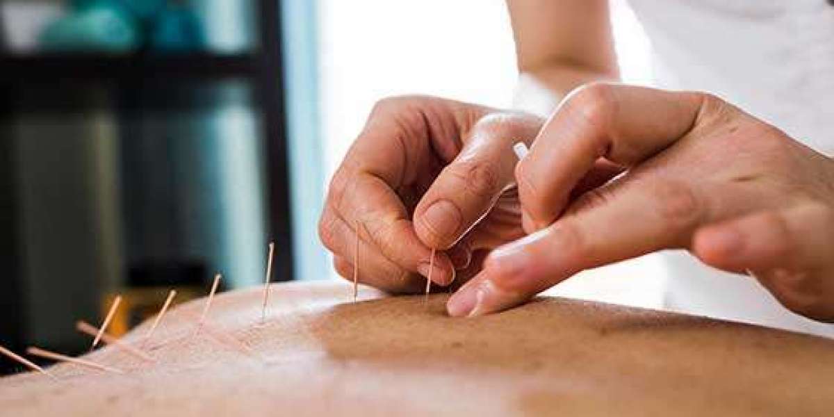 How Virtual Reality and Acupuncture Are Teaming Up to Help You Feel Better in Edmonton