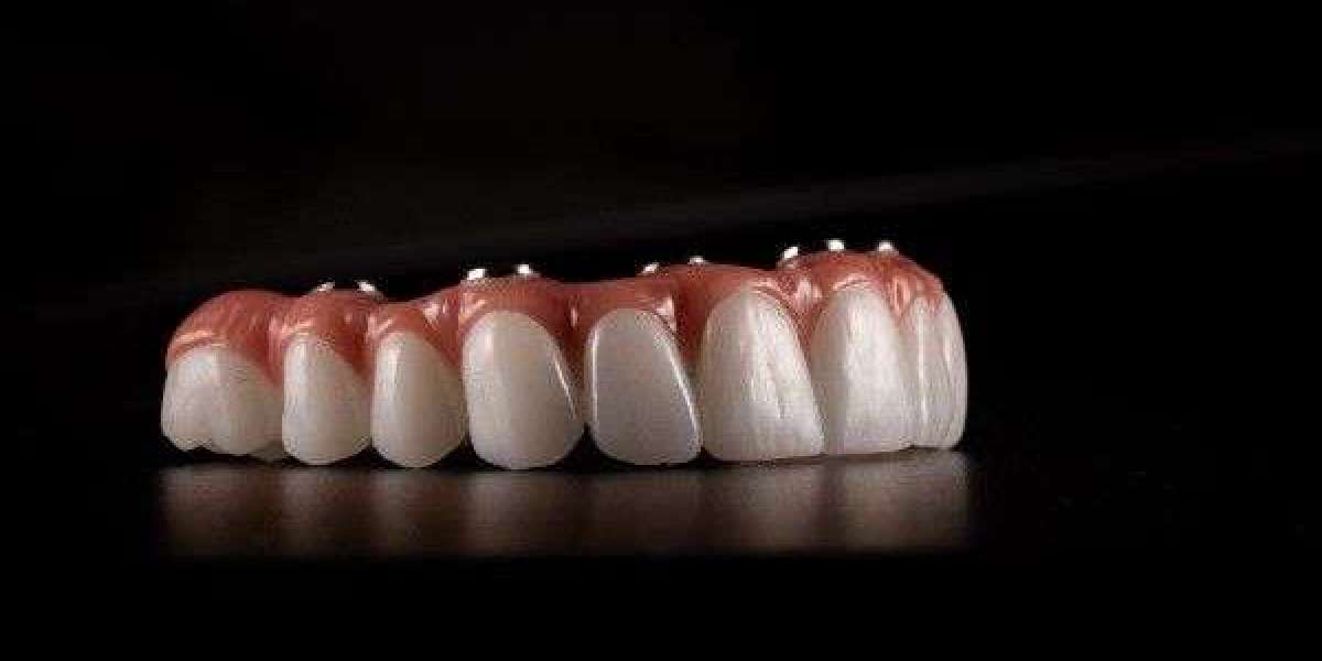Friendly, Professional Care for Your Smile in Ashford