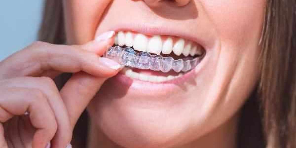 Discover the Simplicity of Straighter Teeth in Newry