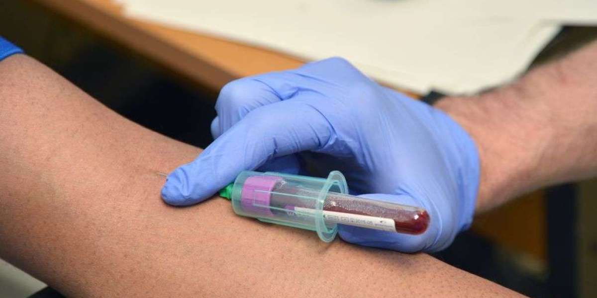 Non-Invasive Prenatal Testing Market Growth 2025, Industry Trends, Demand and Analysis Report by 2033