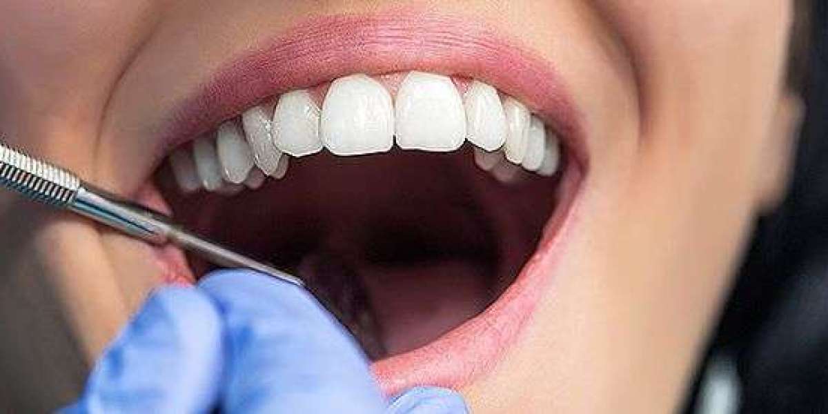 Reviving Your Smile: Everything You Need to Know About Root Canal Treatment in Donnybrook